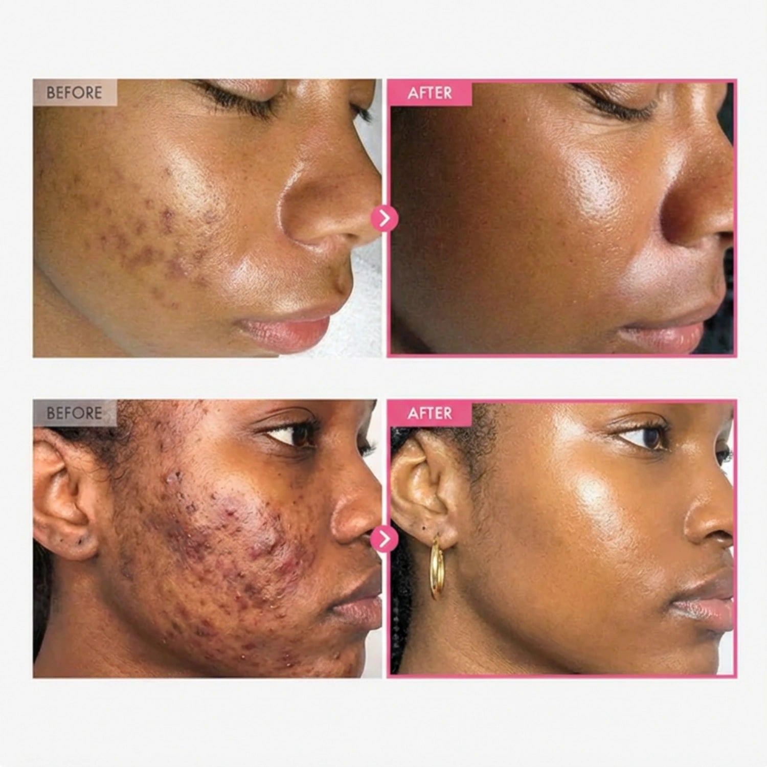 Korean brightening cream