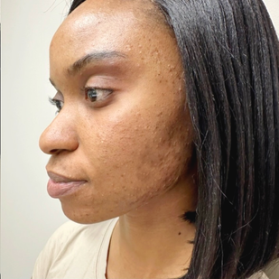 Week 5: Transformation